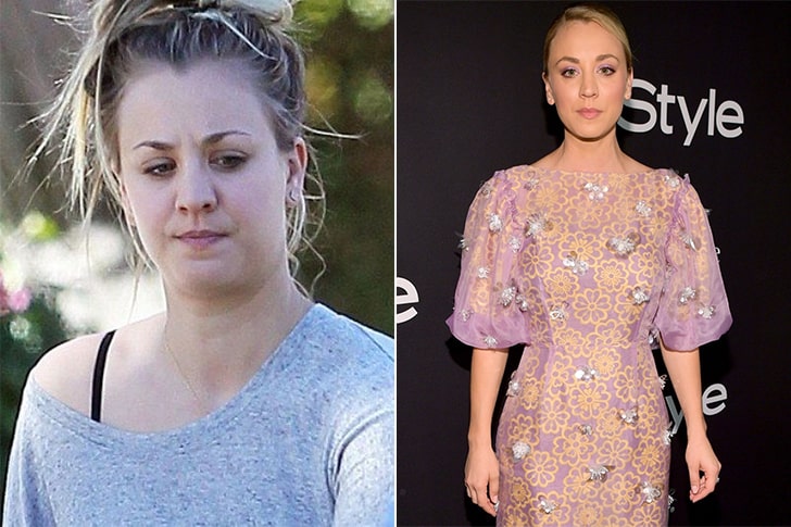 Incredible Celebrity Weight Loss Transformations Direct Healthy