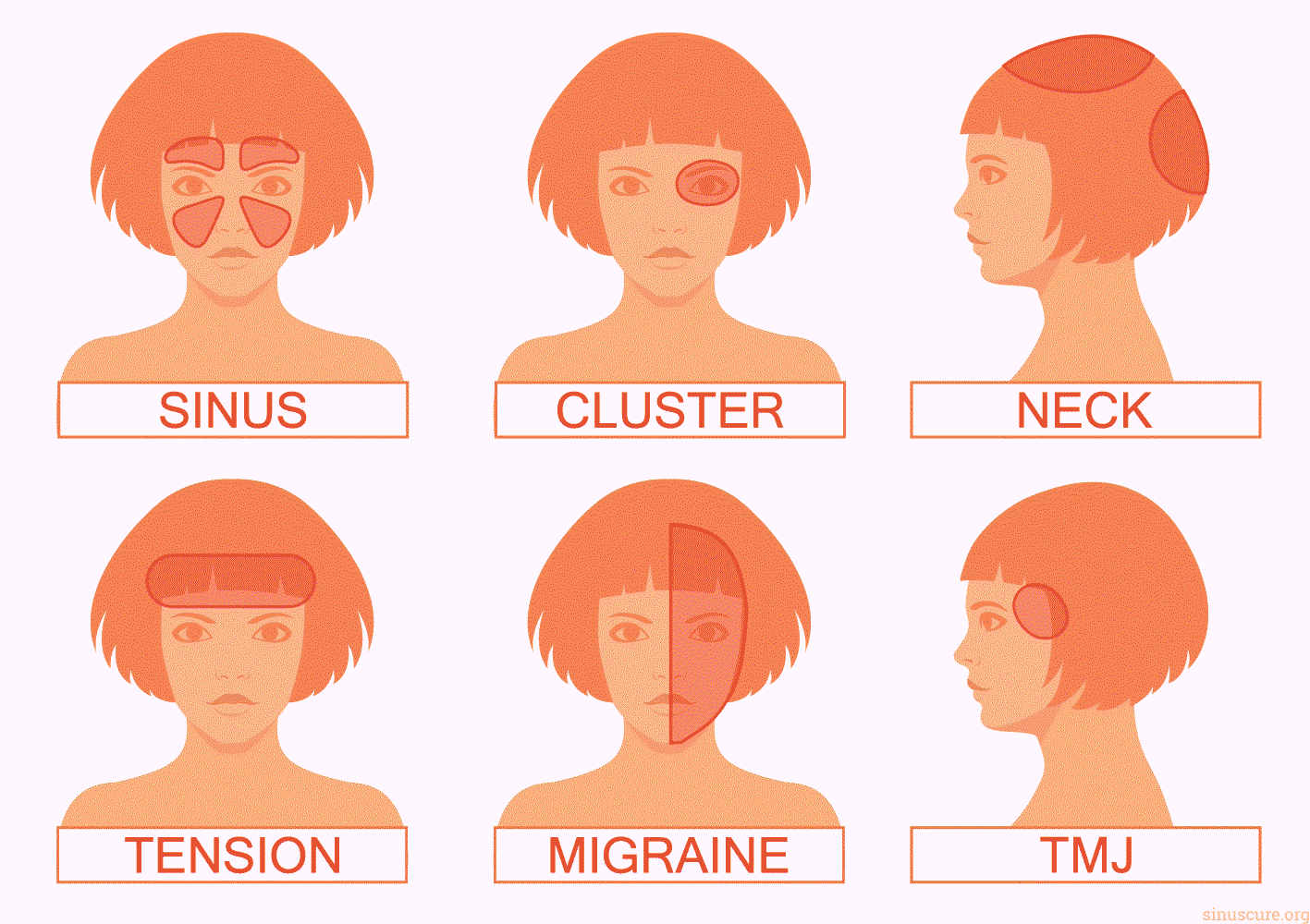 Headaches An Understanding Of Causes When To Start Worrying 