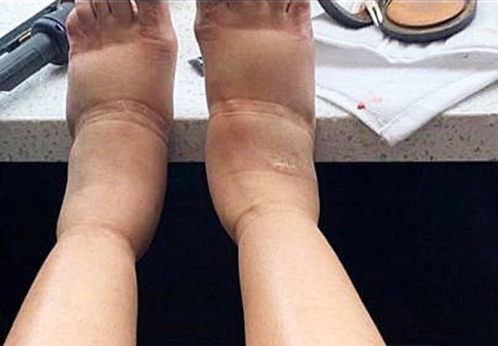 Cardi B shocked her fans with a photo of her swollen feet.